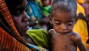 malnutrition cases in mp